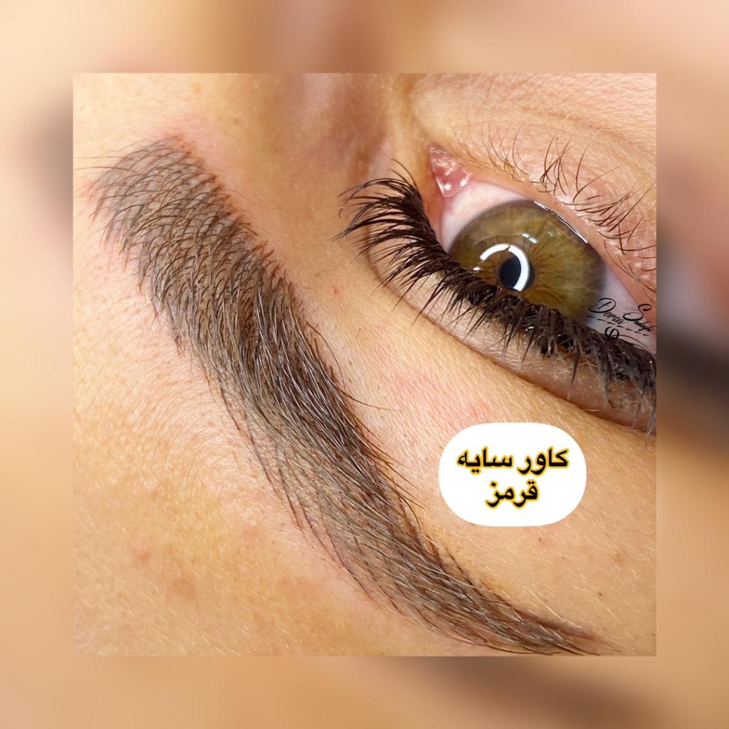 فیبرز ابرو
